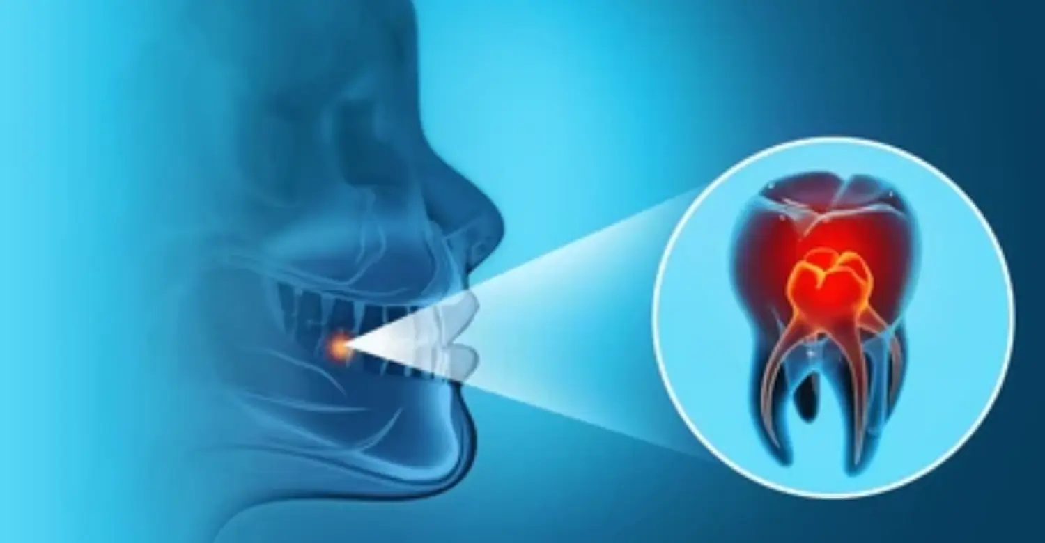 Understanding Random Sharp Pain in Tooth